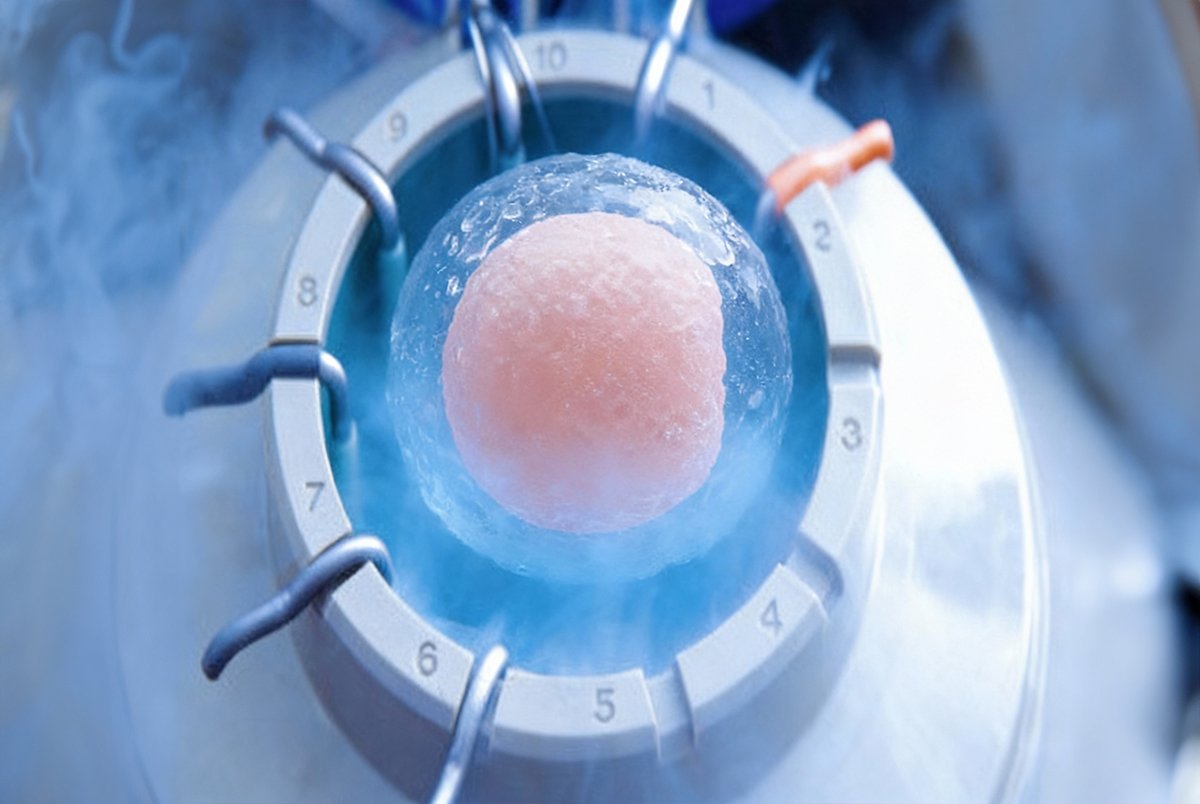 Congelamento de Óvulos em São Paulo: Idade e Custos